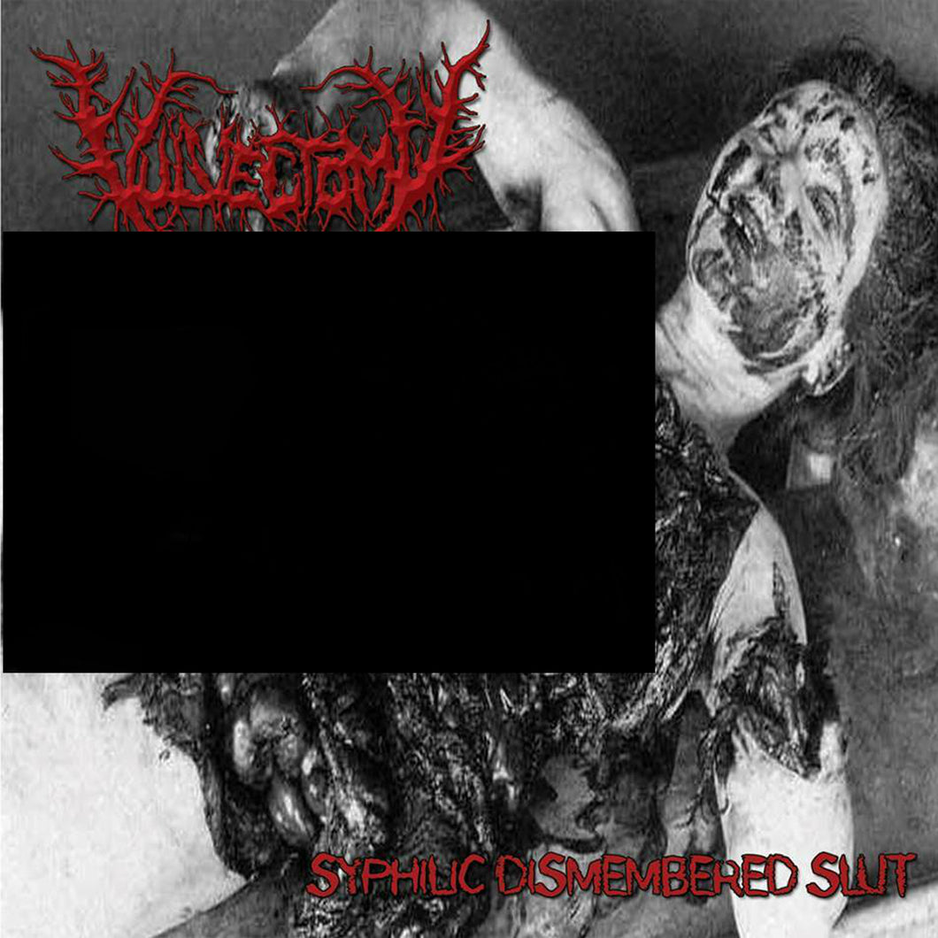 Vulvectomy-Syphilic Dismembered Slut